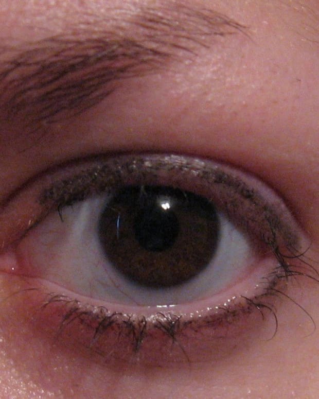 My trichotillomania: pulling out my eyelashes