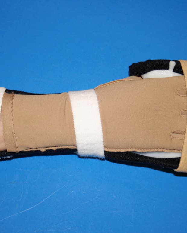 Resting hand splint should cover at least 2/3 of the forearm.  Shown worn with Isotoner glove.  