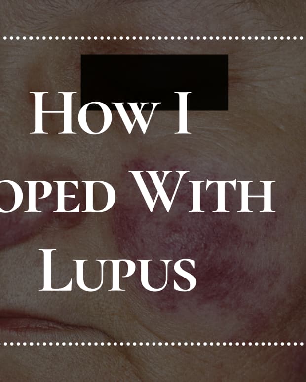 lupus-changes-you-can-make