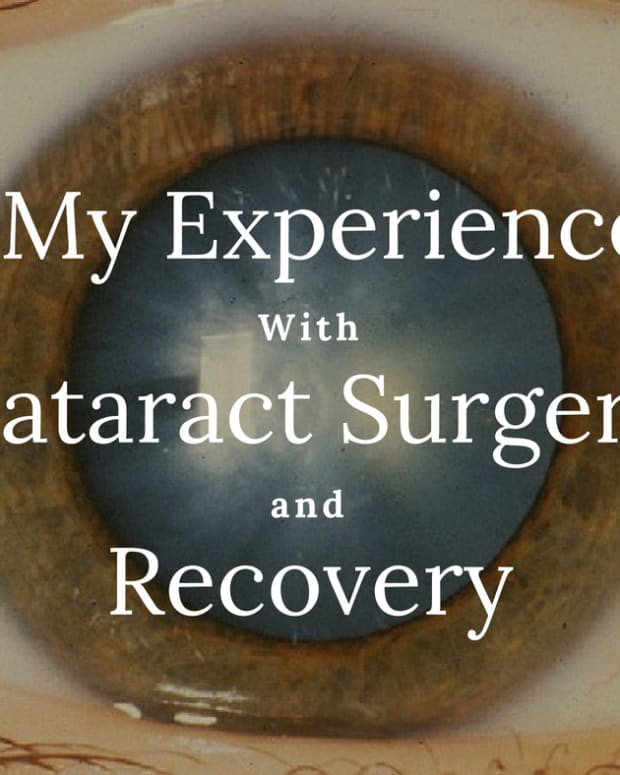 cataract-surgery-operation-and-recovery