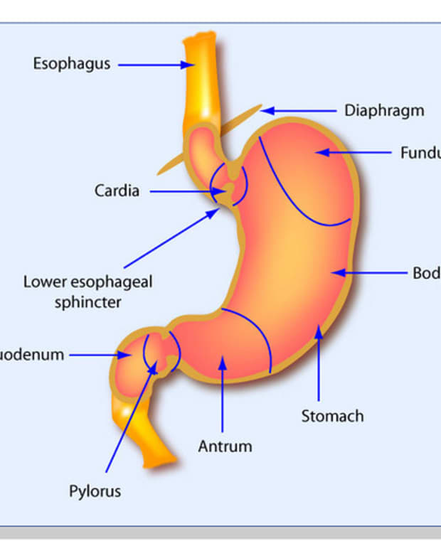 Acid reflux symptoms can involve the stomach or esophagus.