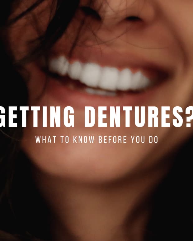 what-you-need-to-know-before-getting-dentures-written-by-someone-who-has-full-dentures