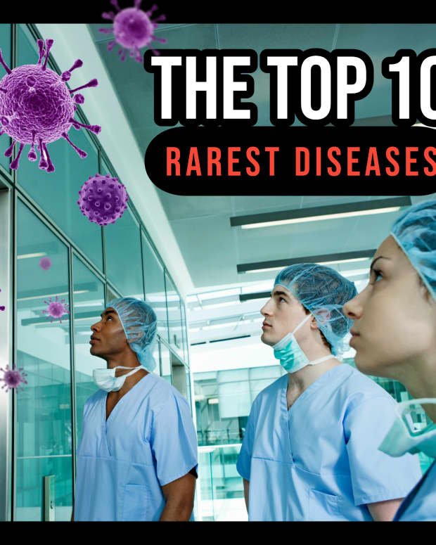 the-top-10-rarest-diseases