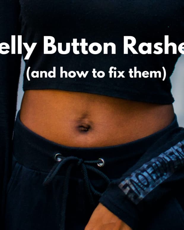 rash-around-belly-button