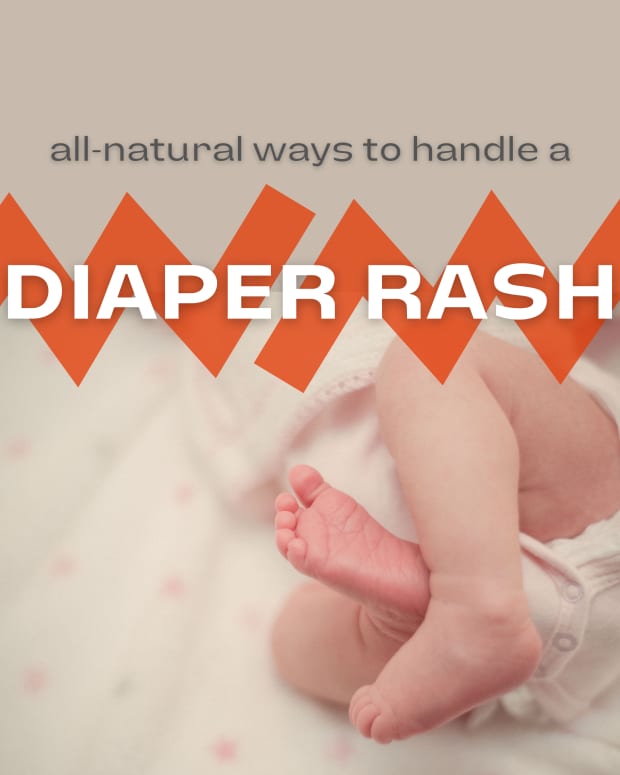 natural-ways-to-treat-diaper-rash