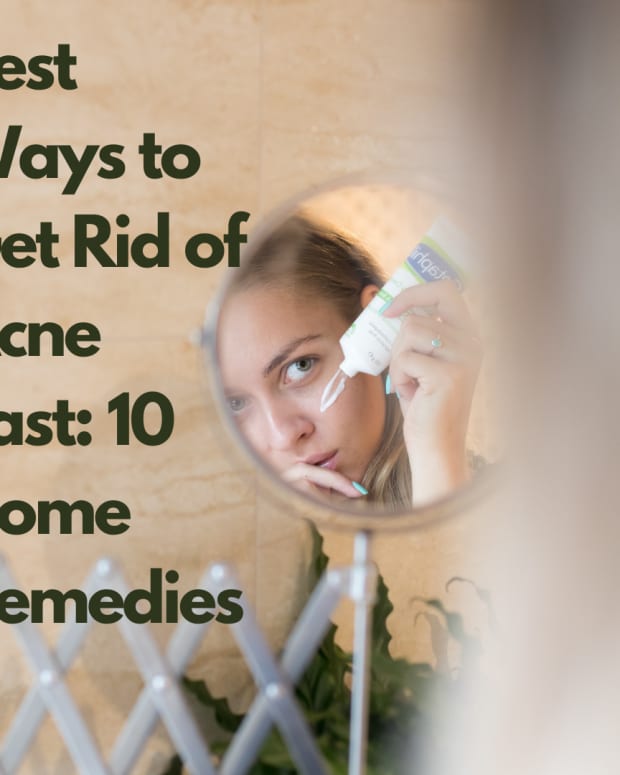 how-to-get-rid-of-acne-overnight-best-ways-to-get-rid-of-acne-fast