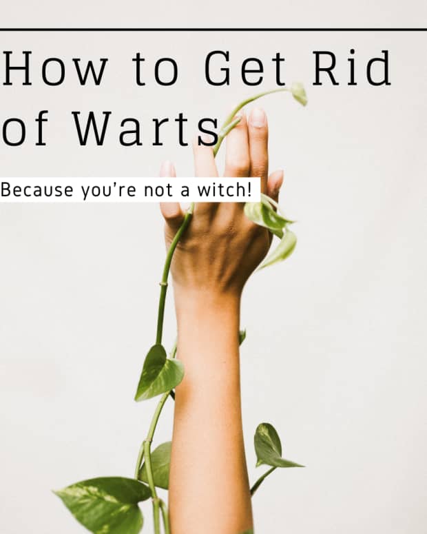 only-witches-want-warts
