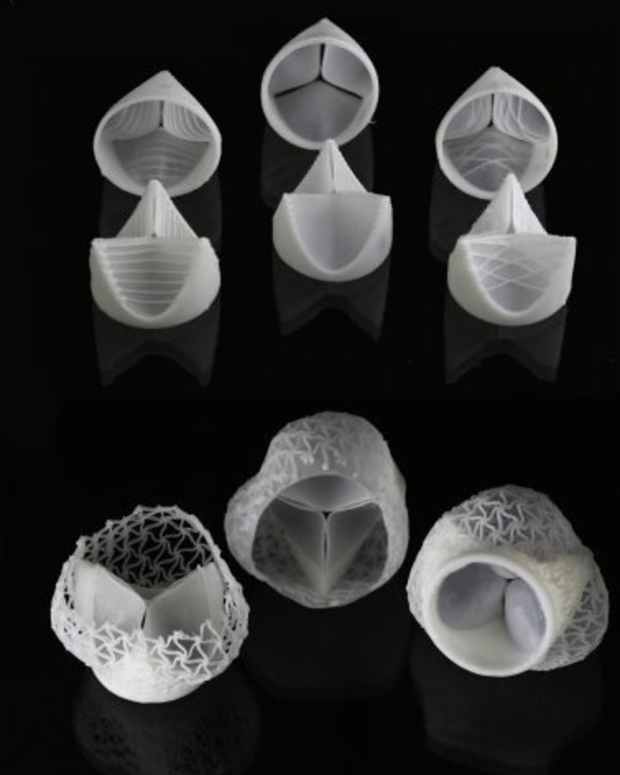 heart-valve-transplant