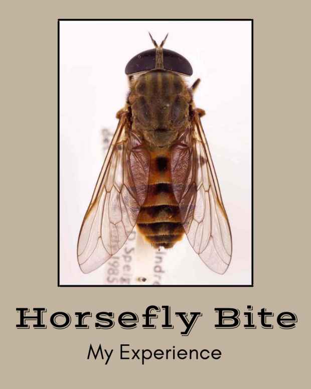 Bullseye Rashes Ringworm and Lyme Disease Differences and My Diagnosis