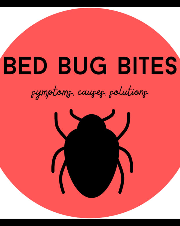 bed-bug-bites-pictures-symptoms-causes-treatment
