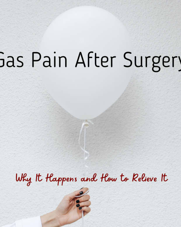 getting-gas-pain-relief-after-surgery
