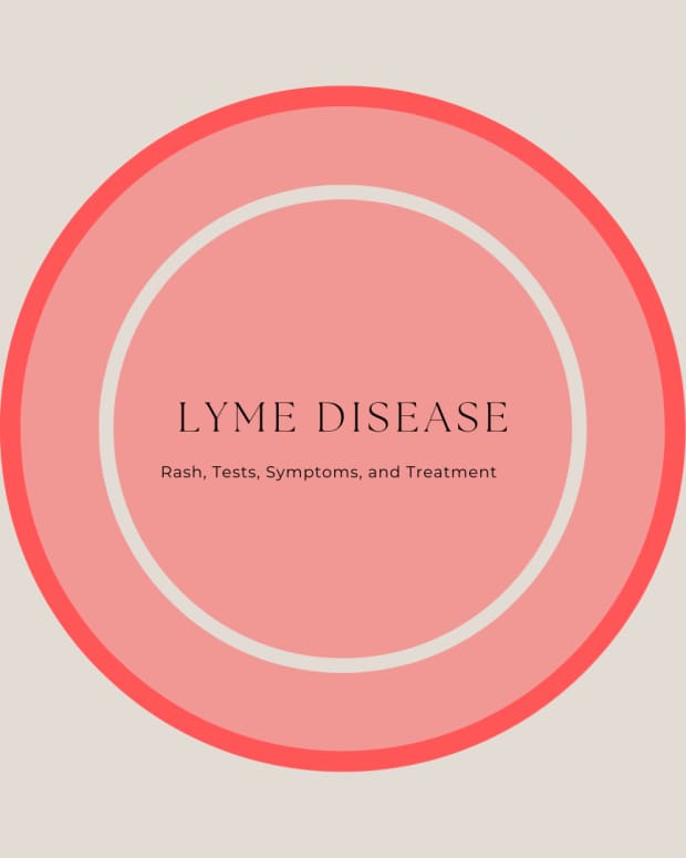 lyme-disease-rash-pictures-test-symptoms-causes-treatment