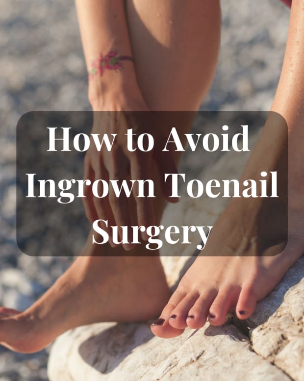 how-to-avoid-ingrown-toenail-surgery
