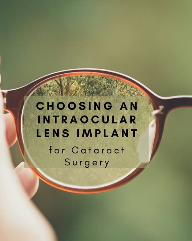 choosing-an-intraocular-lens-implant-for-cataract-surgery