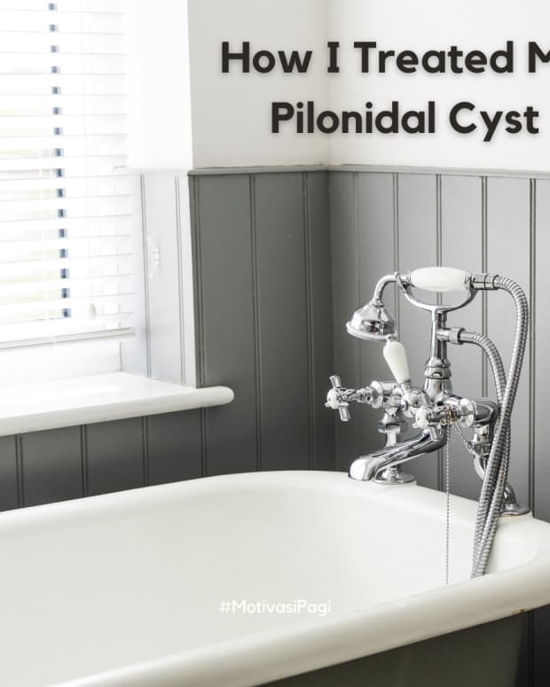 definitive-guide-to-pilonidal-cysts