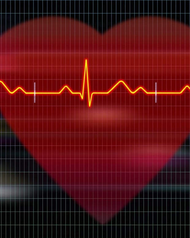 the-importance-of-ekgs-for-heart-health-how-i-discovered-i-had-an-irregular-heartbeat