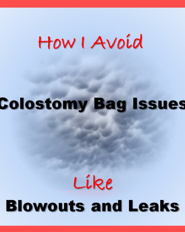 How I Prevent Colostomy Bag Ballooning Patient's Lounge Patient Medical Experiences
