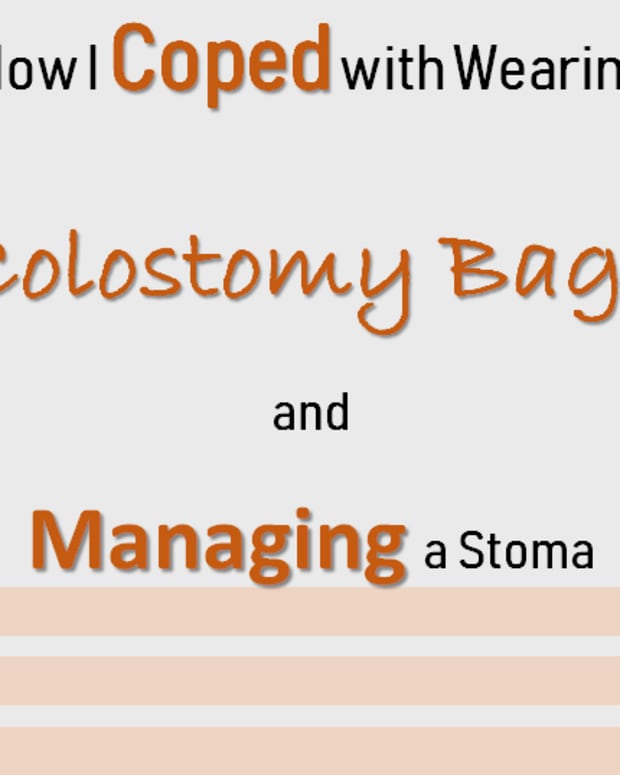 How I Prevent Colostomy Bag Ballooning Patients Lounge Patient Medical Experiences 2934