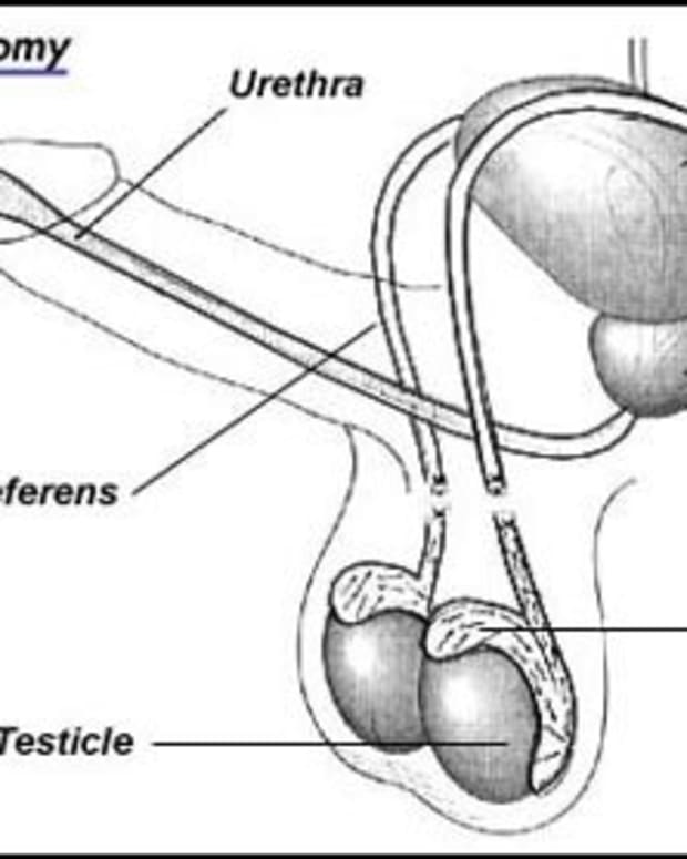 Vitrectomy What To Expect With Macular Pucker Surgery And Recovery