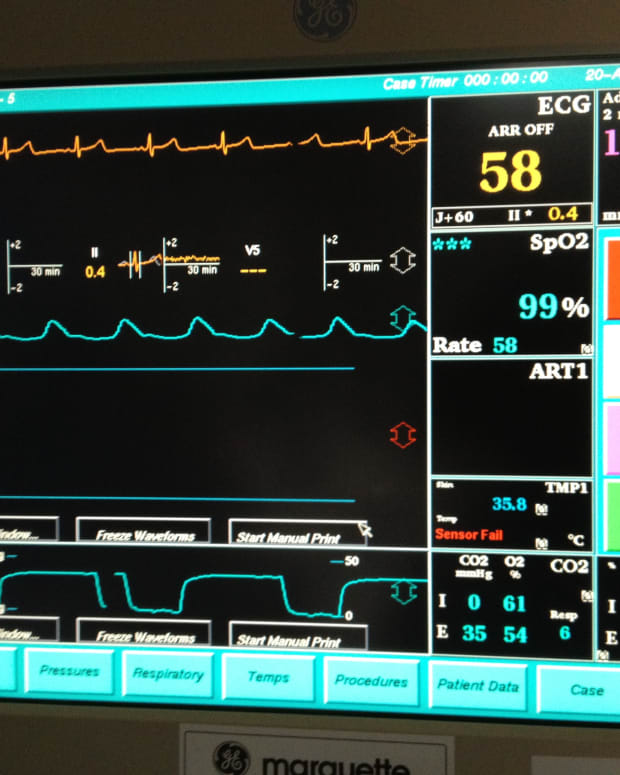 What You Should Know About A Spinal Anesthesia Block Healthproadvice