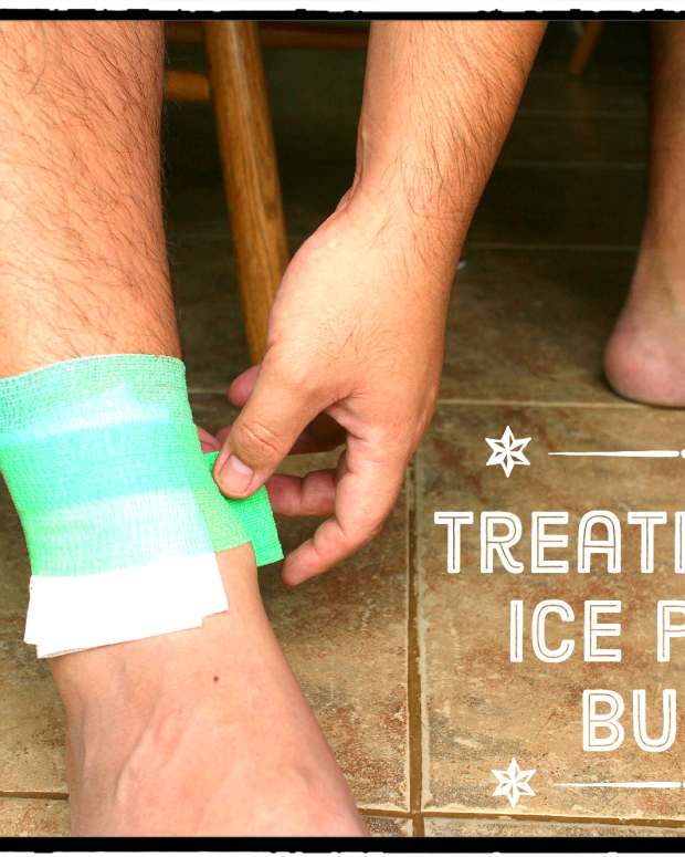 How To Treat a Bee Sting Naturally RemedyGrove