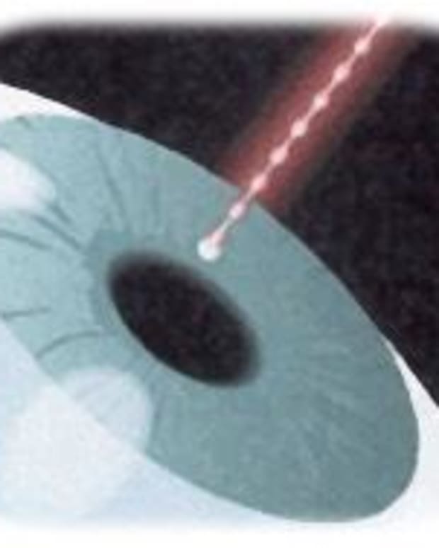 My Story of Treating a Torn Rotator Cuff Without Surgery Patient's