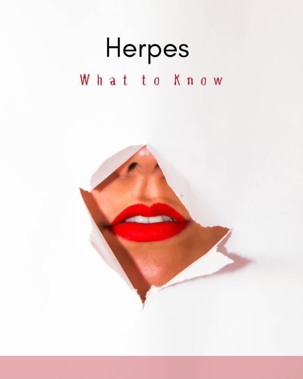 healing-herpes-naturally