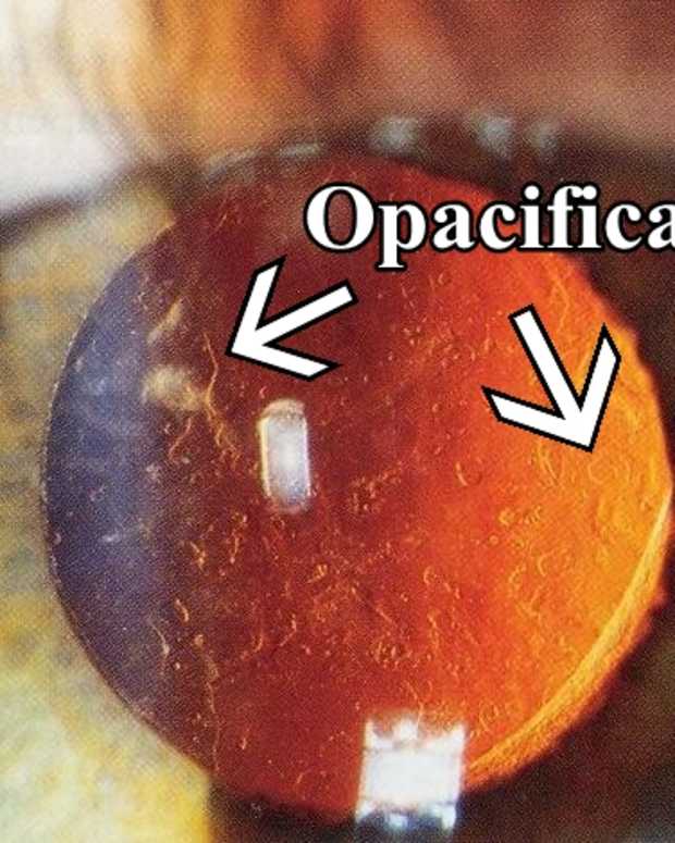 How to Read an Eyeglass Prescription HealthProAdvice