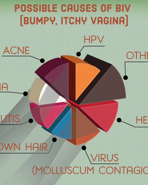 pimple bump on vagina