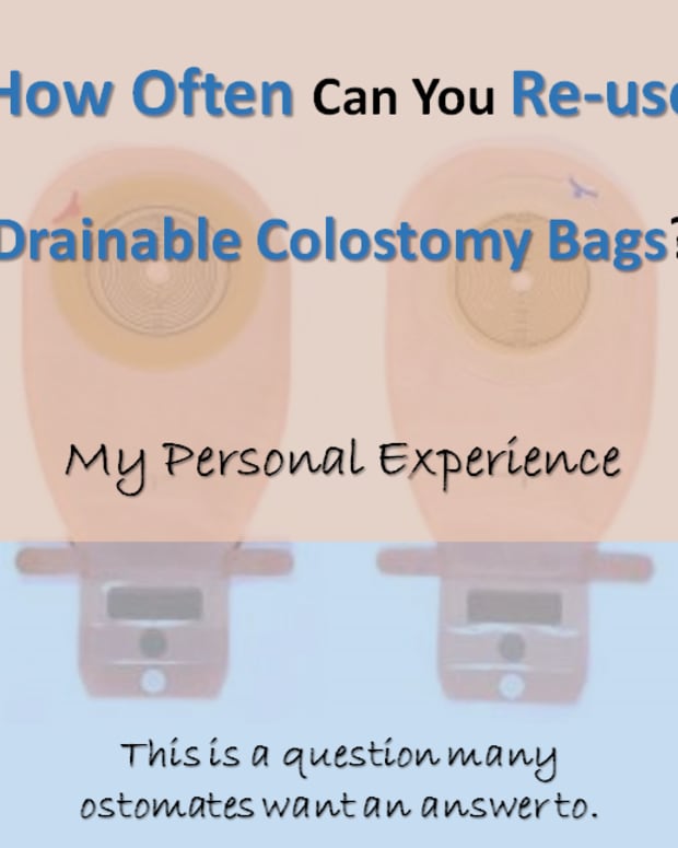 How I Prevent Colostomy Bag Ballooning - Patient's Lounge - Patient ...