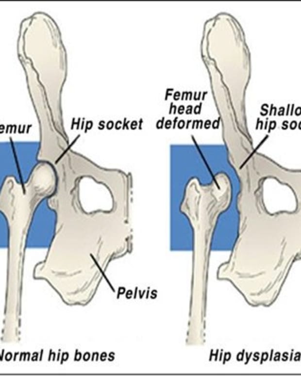 Dog Health: Signs and Symptoms of Dog Hip Dysplasia - PetHelpful - By ...