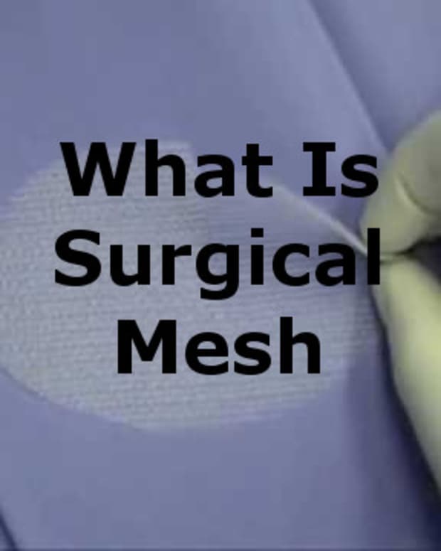 Reflex Action and Reflex Arc What Happens When You Accidentally Touch a Hot Pot Owlcation