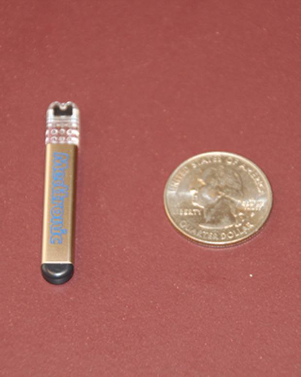 The Implantable Medtronic Cardiac Loop Recorder A Personal Experience