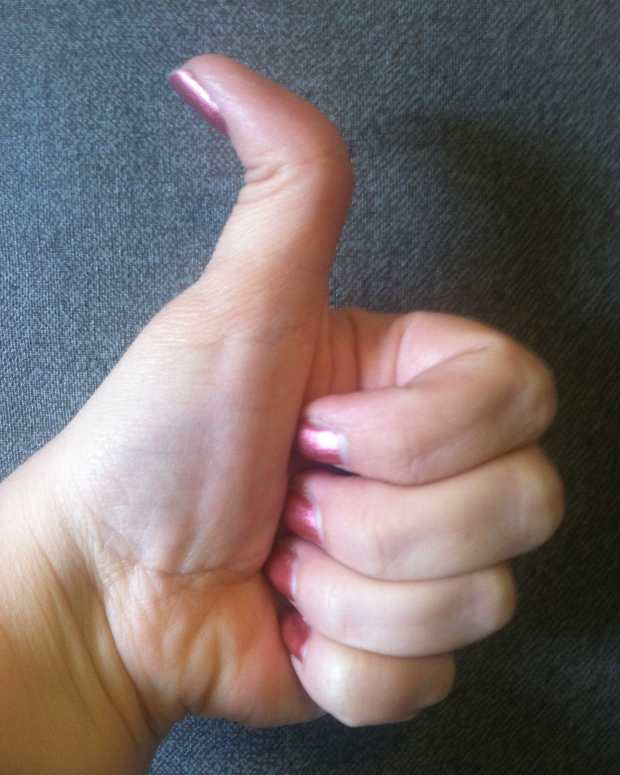 What Is Pectus Excavatum? Growing Up With PE, Causes, Surgery, and