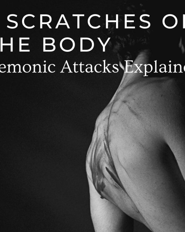 Why Did I Wake up With 3 Unexplained Scratches/Cuts on My Body? Exemplore Paranormal