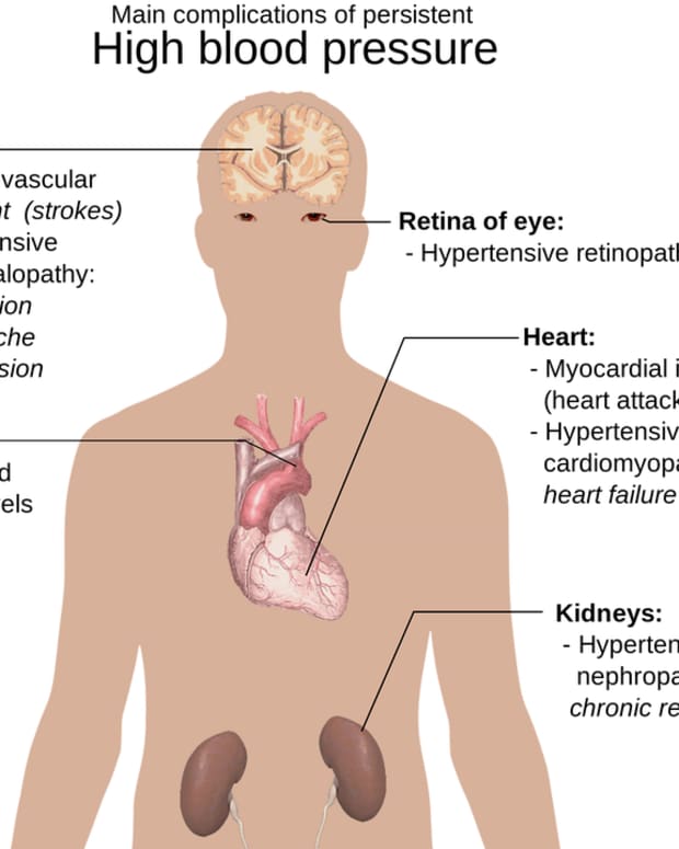 managing-hypertension-before-it-will-be-too-late
