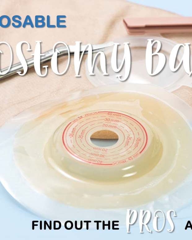 How I Avoid Colostomy Bag Leaks and Blowouts Patient's Lounge