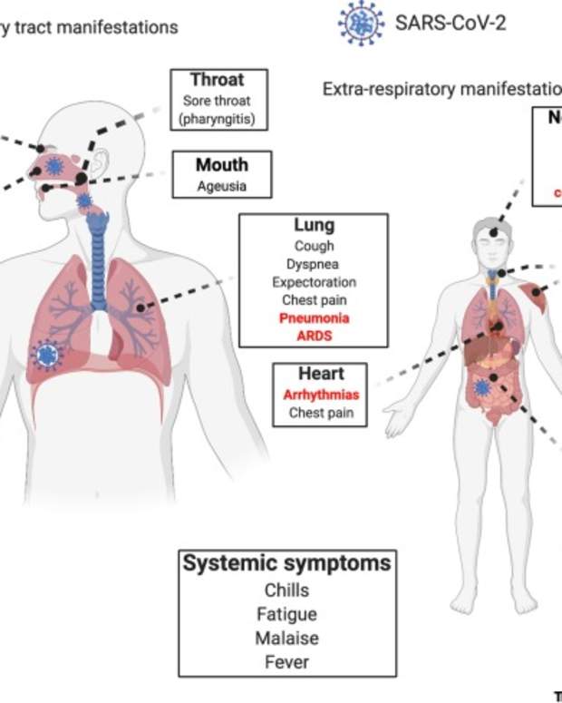 gastrointestinal-distress-in-sars-covid-19-era