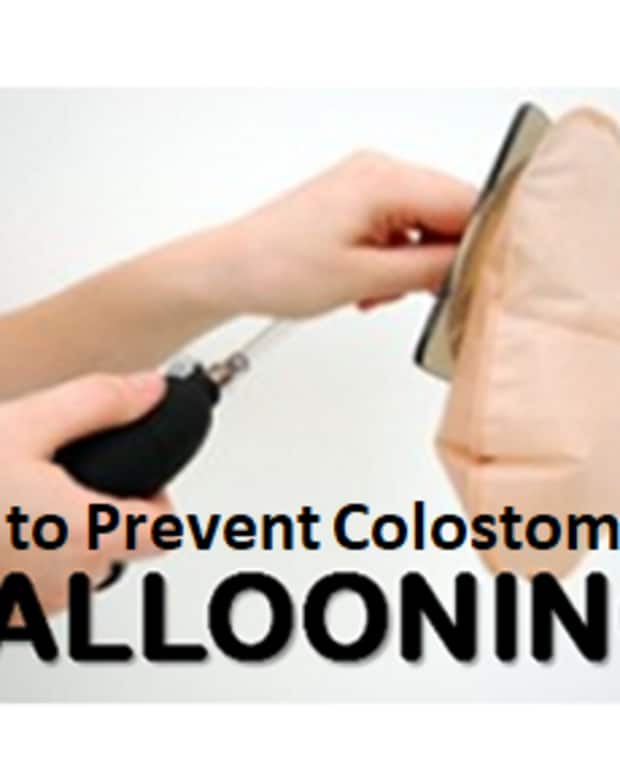 My Colostomy Reversal Story Patient's Lounge