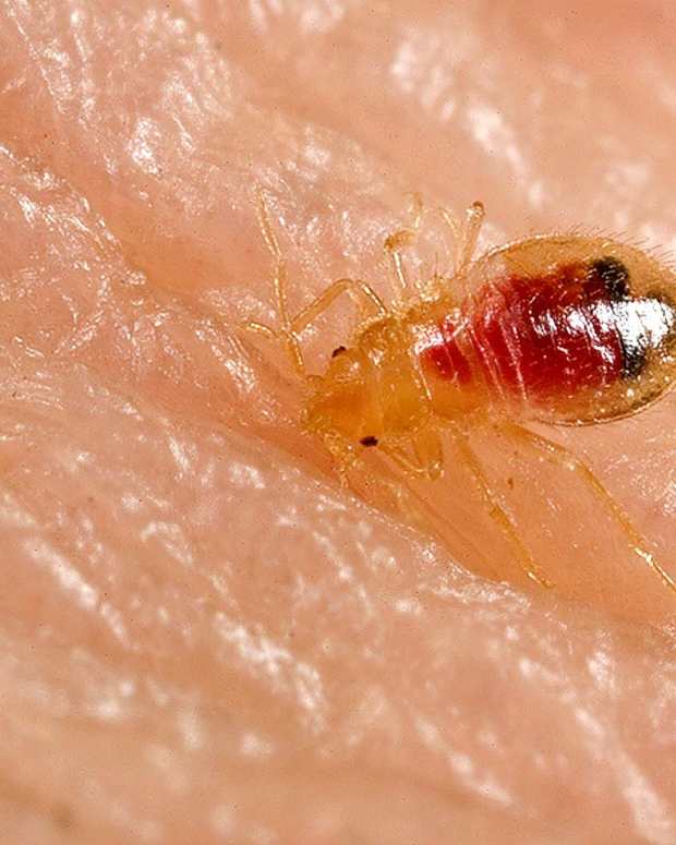 What's Biting Me? Being Eaten by Invisible Bugs in Your Home