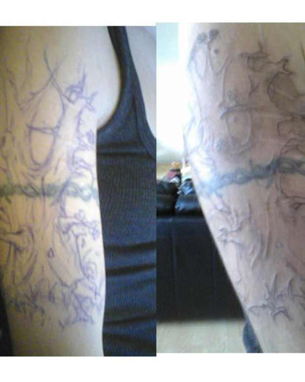 My Experience Lightening and Removing My Tattoo at Home TatRing