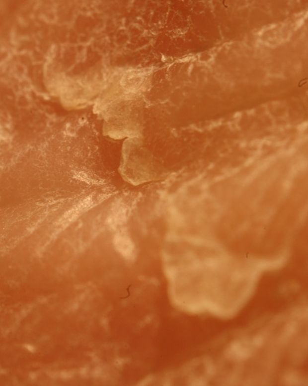 Treatment for Cracked, Bleeding Heels and Feet RemedyGrove