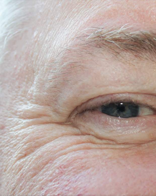 Facts, Symptoms, and Treatments for Dry Skin Behind the Ears