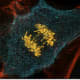 A fake colour image micrograph of a dividing cell in Anaphase