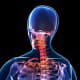 Lupus pain may also occur in the neck and shoulders.