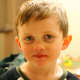 The author's 5 year old son, 4 days after his revision supraglottoplasty. Feeling tired and weak, but improving every day.