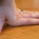 Hypermobile finger joints
