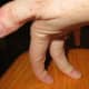 Hypermobile fingers, makes typing hard
