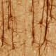 These are brain neurons. Notice all the space between them. It's all flesh mixed with water. The water is necessary to separate the dendrons a bit, so they're not always charging us to action. (Hmmm. Wonder if that's a cause of ADHD?)