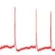 new-level-of-coma-after-flat-line-neurophysiologists-discover-brain-re-ignition